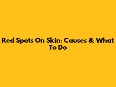 Red Spots On Skin: Causes & What To Do